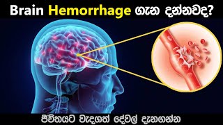 මොළයේ රුධිර වහනය ?| Brain Hemorrhage | symptoms , causes and treatment sinhala