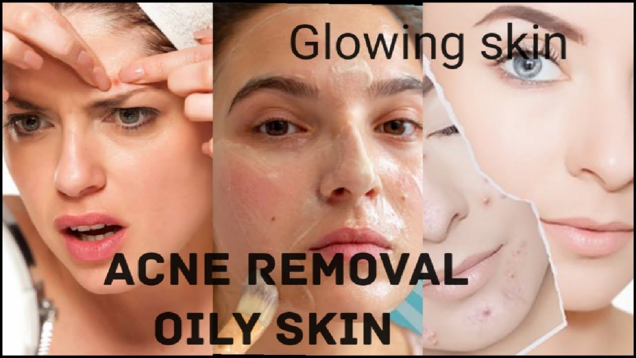 Asmr Acne Removal Treatment !! Glowing skin k liye !! asmr asmrsounds 