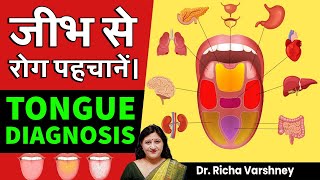 How To Do Tongue Diagnosis & Identify Health Problems || Dr. Richa Varshney
