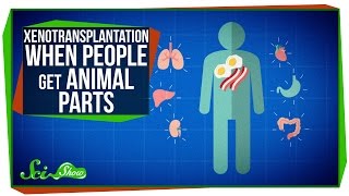 Xenotransplantation: When People Get Animal Parts Xenotransplantation: When People Get Animal Parts