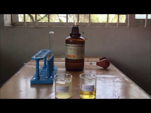 Albumin Detection in Urine = Sulfosalicylic Acid and Nitric Acid (ENGLISH) By Solution Pharmacy