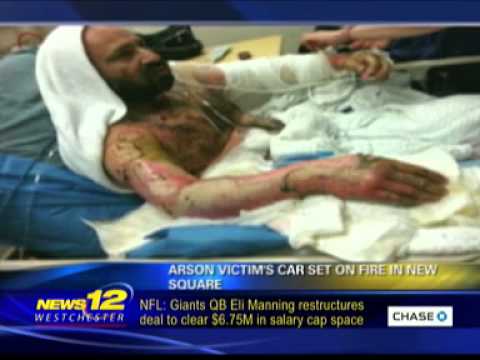 New Square Burn Victim Aron Rottenberg Car Set On Fire Another Arson Attack