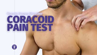 Coracoid Pain Test | Adhesive Capsulitis Diagnosis