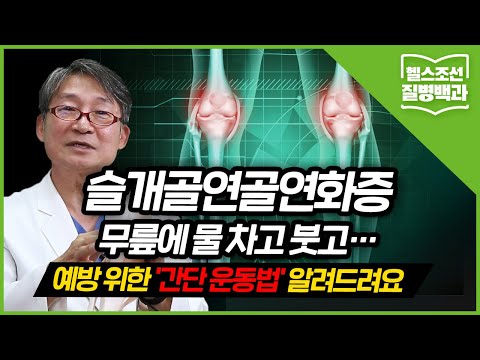 [슬개골연골연화증] 앉았다 일어날 때만 아프니 괜찮다? 무릎 연골 닳았을 수도… 방치하면 퇴행성관절염까지