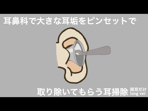 【ASMR】耳鼻科で大きな耳垢をピンセットで取り除いてもらう耳掃除  両耳だけ long ver Ear Cleaning 【No Talking】