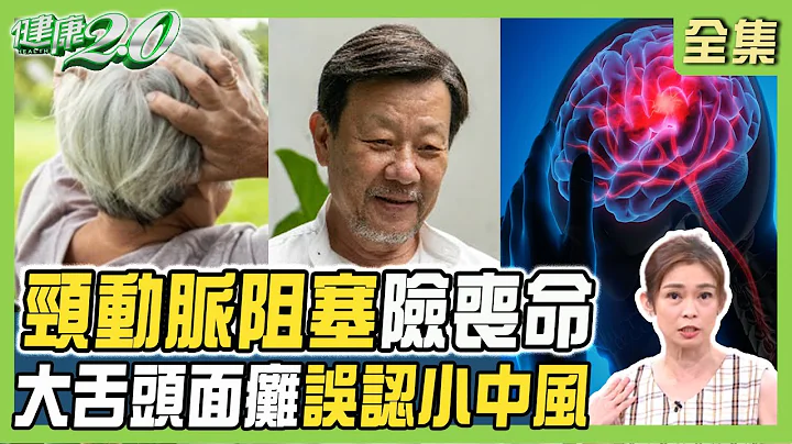 寇世勋水喝不够 颈动脉阻塞险送命！大舌头、面瘫误认小中风 竟是颈动脉阻塞脑缺血！ 健康2.0 20230729【完整版】 郑凯云 康志森 丁贤伟 刘怡里 小CALL 雷议宗 Cherry - 天天要闻