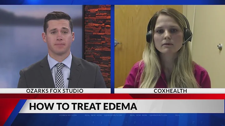 Ozarks Tonight: How to treat edema