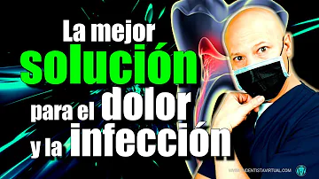 ¿Ayudan los antibióticos a aliviar el dolor del nervio dentario?