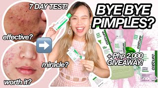 TRYING OXECURE'S MIRACLE PRODUCTS FOR 7 DAYS TEST! Honest Review+ 2,000 Giveaway! Get Rid Of Pimples