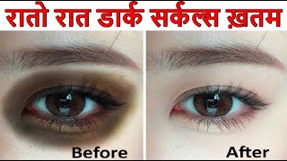 1 मिनट में आपके आंखों के Dark Circles को गायब करे | Asardar Gharelu Nuskhe to Remove DARK CIRCLES