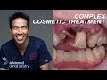 FIX ALL MY TEETH - Complex Smile Makeovers