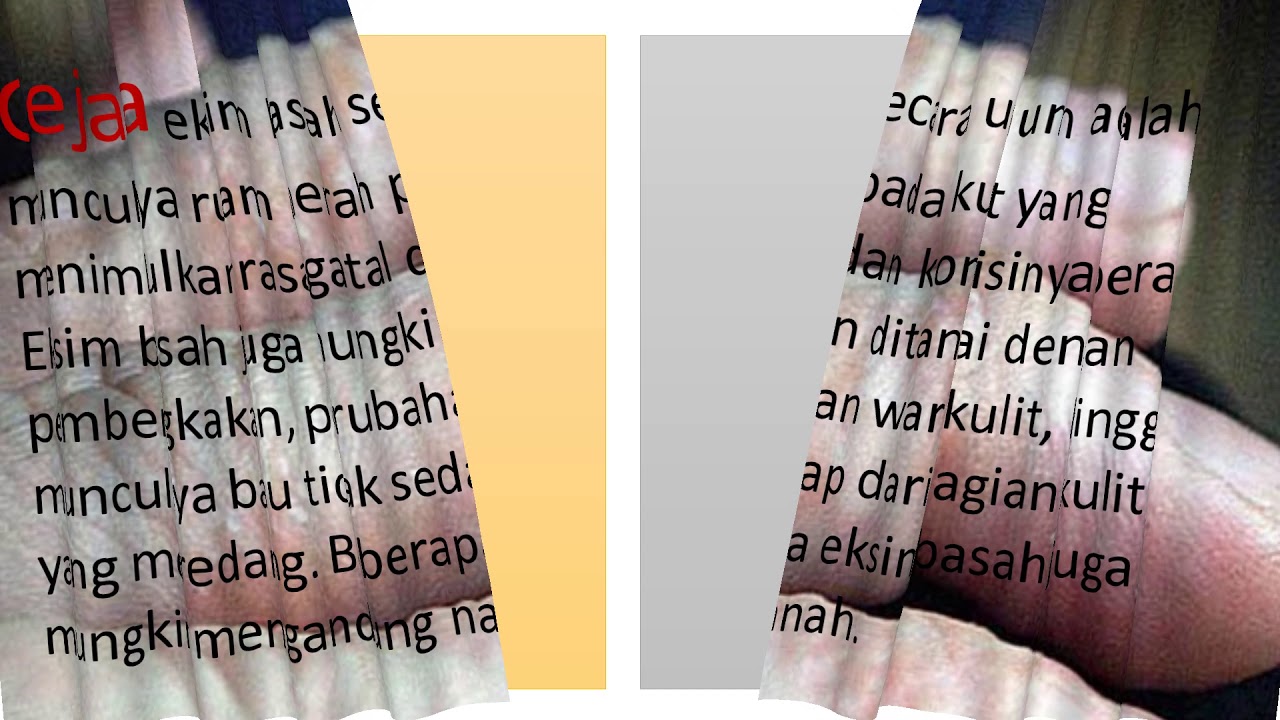eksim basah 6