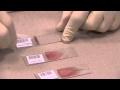 Idexx  how to make a blood film in 3 steps