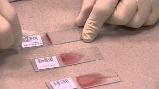 Ide - How To Make A Blood Film In 3 Steps