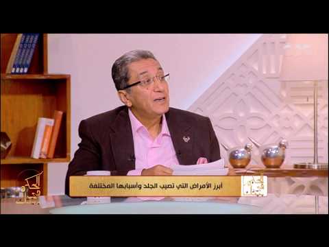 الحكيم في بيتك أهم طرق علاج عين السمكة وسبب الإصابة بها