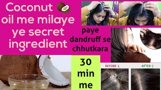 Dandruff से छुटकारा सिर्फ 30 मिनट मे। get rid of dandruff in 30 minutes