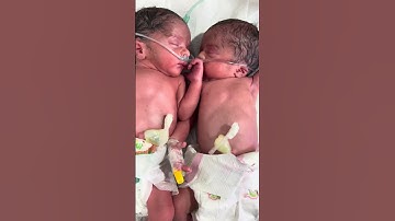 Newborn Twins in NICU | Oxygen-Dependent but Improving | Nurse Care & Monitoring #newbornbaby