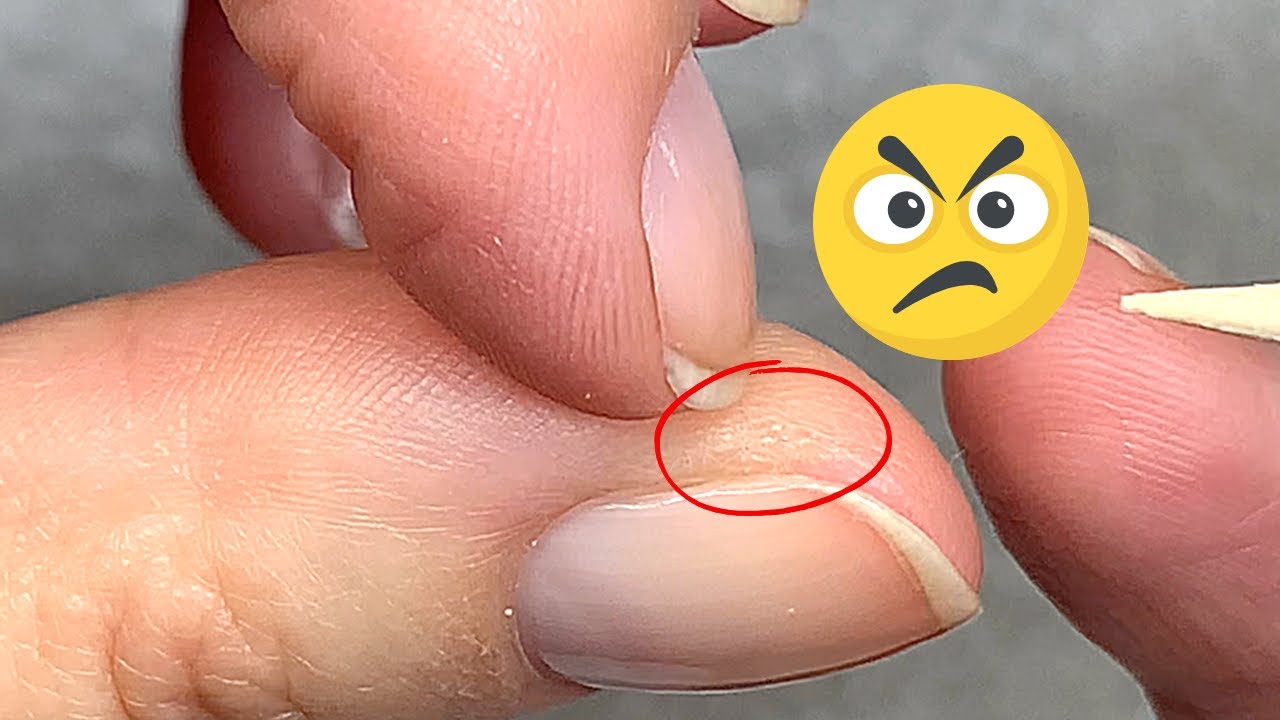 How to Stop Skin Peeling around Nails | TikTok