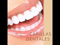 carillas dentales madrid