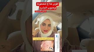 اقوى مكونات لعلاج التجاعيد وحبوب البشره 2023 #ريفيوهات #العناية_بالبشرة #skincare #explore