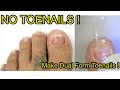 I Don't Have Toenails On My Large Toes !  I Make Clear Polygel Dual Form Toenails The Easiest Way