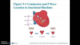 Cardiac Chapter 9 Video 1