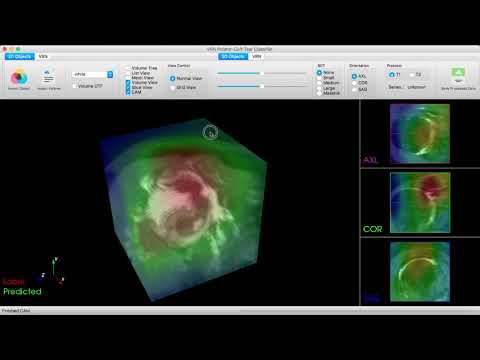 Class Activation Map(CAM) variation training 3D-CNN