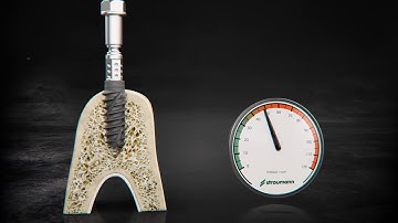 Straumann BLX – Dynamic Bone Management