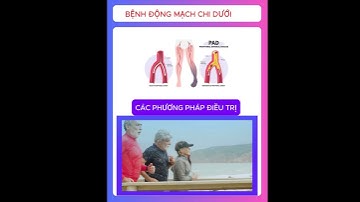 các phương pháp điều trị bệnh động mạch chi dưới