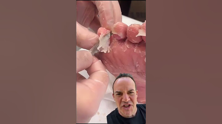 DOCTOR REACTS: DON’T PEEL SKIN OFF YOUR FEET!😱#shorts