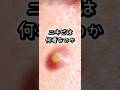 ニキビは一体何者なのか #知識 #雑学 #プチ知識 #雑学ショート #一分でわかる