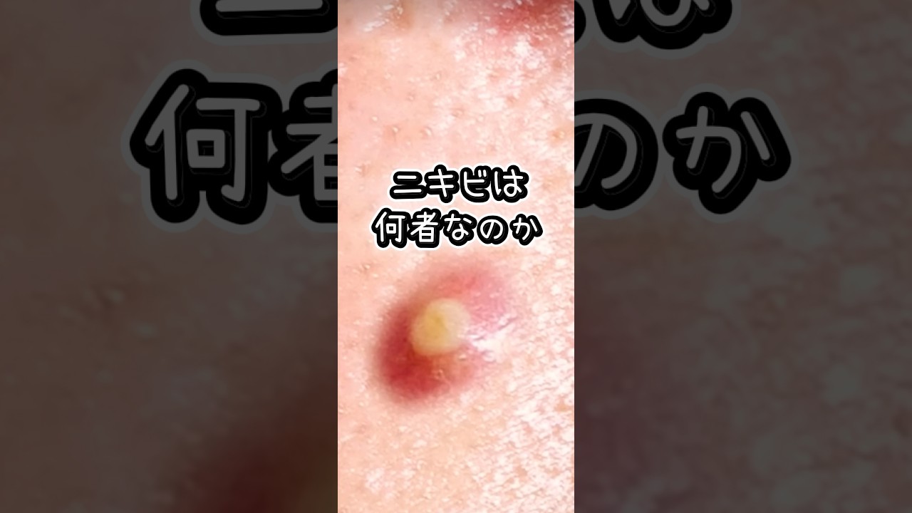 ニキビは一体何者なのか #知識 #雑学 #プチ知識 #雑学ショート #一分でわかる