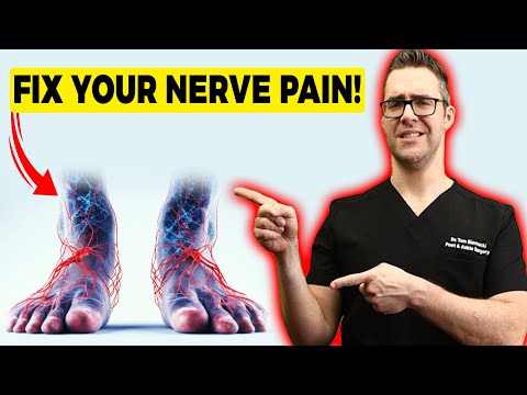 Video: Niyə mən tendonit alıram?