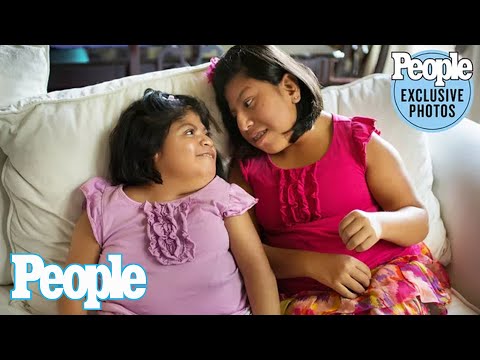 Conjoined Twins Who Made Headlines for 2002 Separation Surgery Turn 21 | PEOPLE