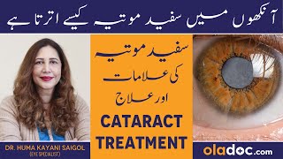 Cataract Kya Hai In Urdu/Hindi - Safed Motia Ka Ilaj - Cataract Treatment - Safed Motia Kya Hota Hai