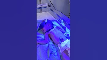 Treatment of Phototherapy in newborn for neonatal jaundice.      #Med
