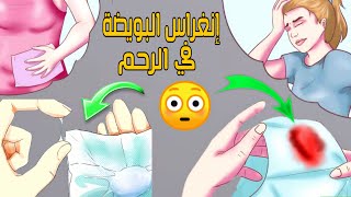 العلامات الأكيدة لإنغراس البويضة في جدار الرحم بعد العلاقة الحميمة مباشرةً