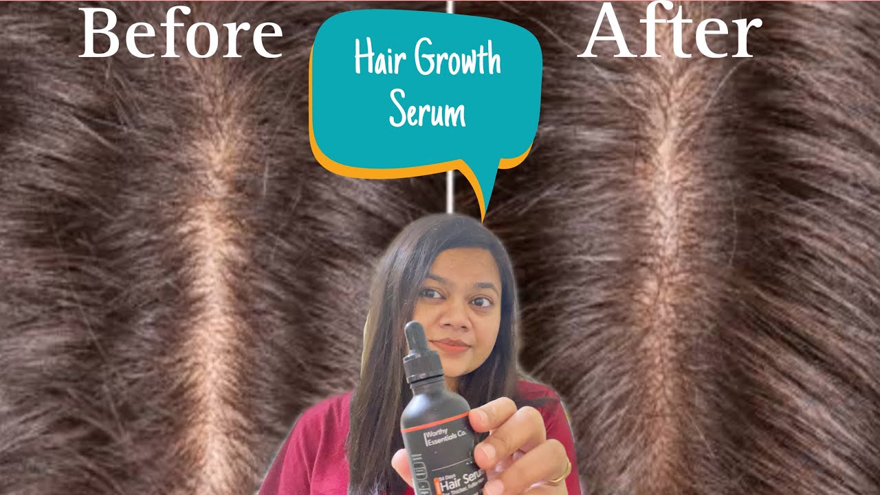 Worthy Essentials 84 Days Intense Hair Growth Serum Honest Review YouTube