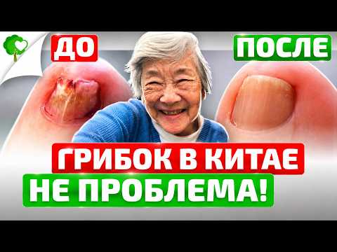 Podiatrist: Do This Every Night to Get Rid of Toenail Fungus (Most People Wait Too Long)