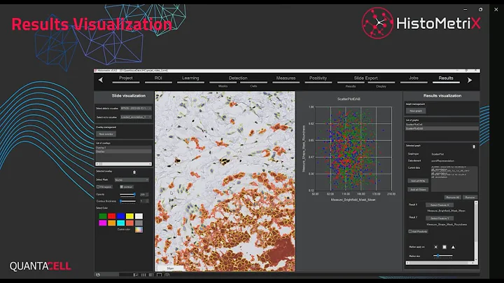 Demonstration of HistoMetrix 2024: the histology image analysis software accessible to all