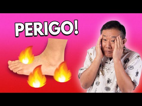 Vídeo: Os pés palmados são um sinal de endogamia?