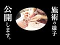 【初公開】フットの施術すべて見せます!