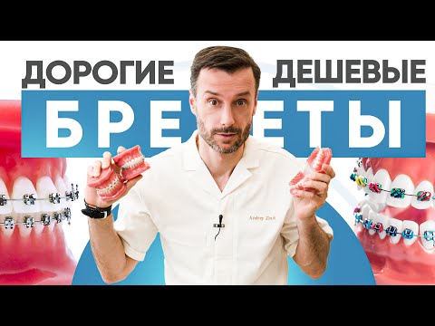 Самые дорогие и самые дешевые брекеты – в чем разница?