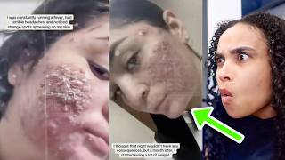 42,000 CAUGHT Herpes And MANY Other STDs During Houston Spring Break! Dont Come To Dallas!