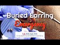 A Football Player's Buried Earring Emergency