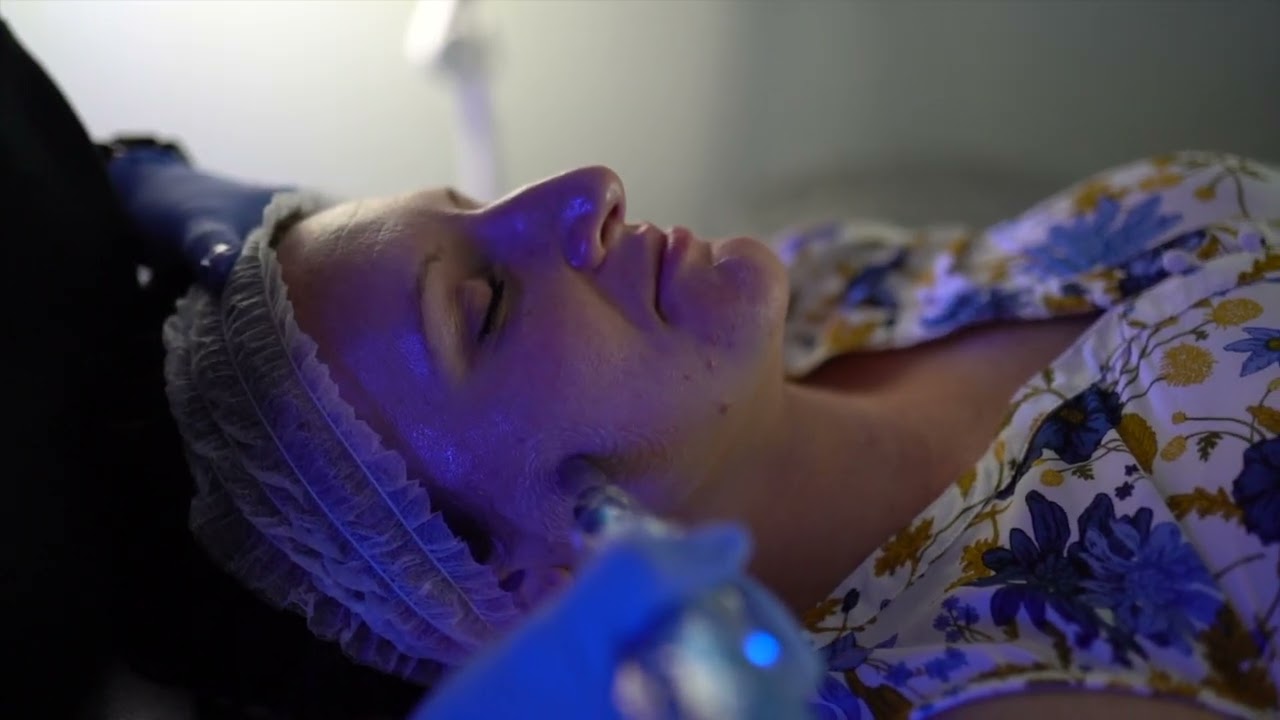 Microneedling with Growth Factor at Blue Halo Med Spa