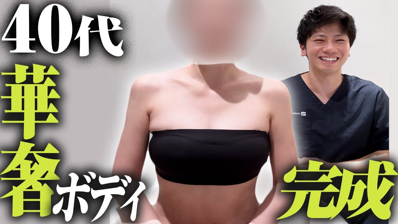タイトな服が着たくて二の腕・お腹の脂肪4000cc吸引したら人生変わるレベルで激変【100万cc吸引する医者】【松元宗一郎】