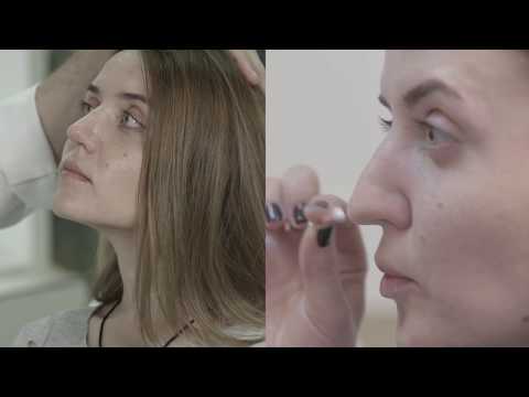 Моя история. Ринопластика (пластика носа). Отзыв