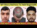 My Story Hairloss To Hair Regrowth | मैंने अपने झड़ते हुए पतले बाल को घना मोटा कैसे किया 😯 Naturally