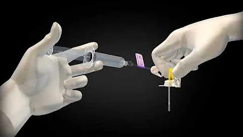 PowerLoc™ Port Access Kit Demonstration